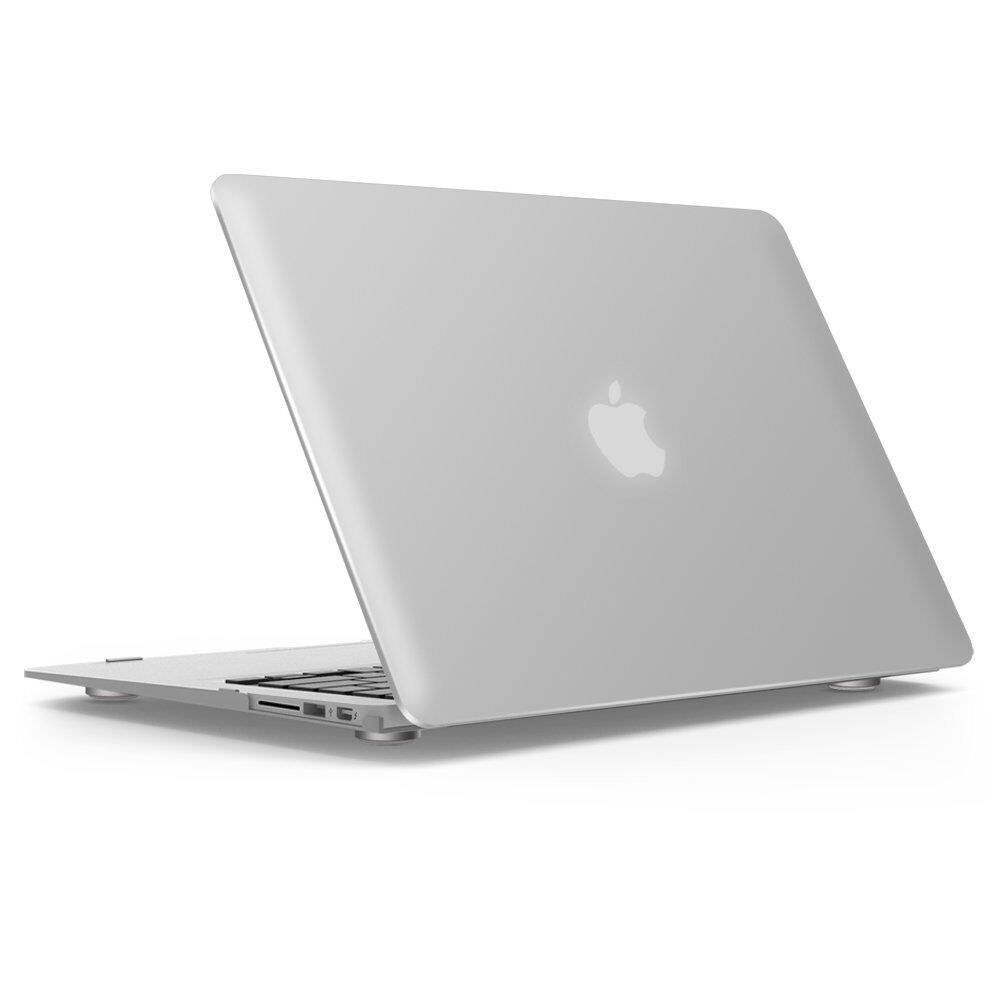 Neon Party Macbook Case